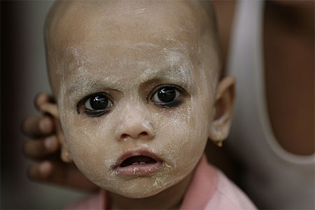 Enfant birmane originaire du Bangladesh